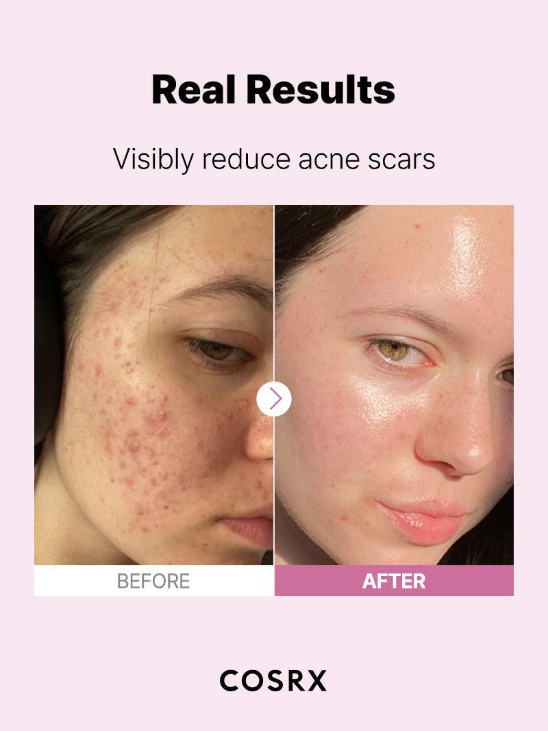 The Niacinamide 15 Serum | Cosrx at Broadway